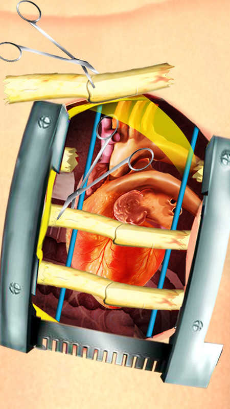 Open Heart Surgery Simulator APK Free Simulation Android Game download