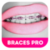 Braces Booth 20 For Instagram Icon