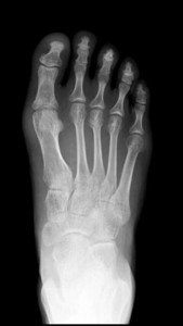 X-ray Scanner Prank